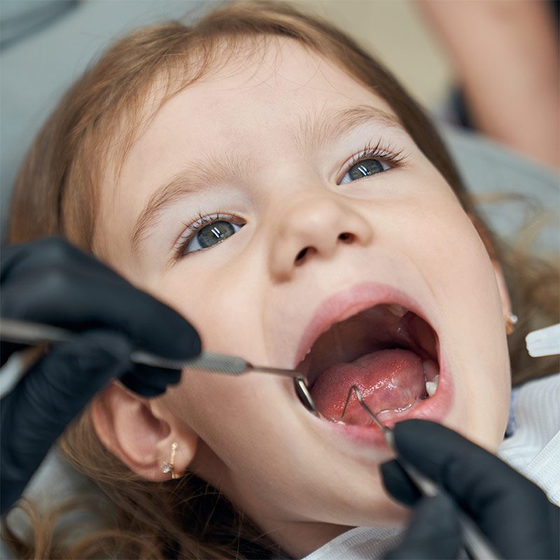 Qué es la odontopediatría